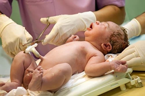 фото новорожденных детей в роддоме сразу после родов