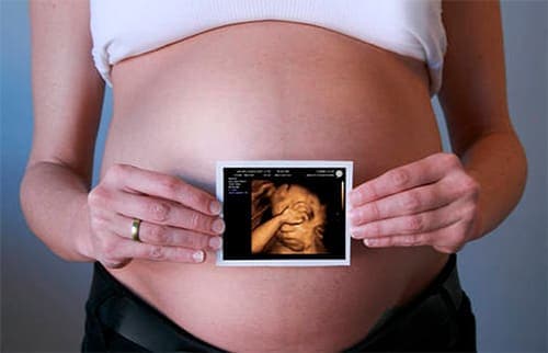 hd живое узи при беременности фото