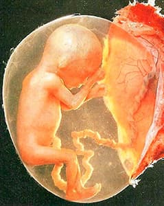 Выделения беременности на 4 месяце беременности thumbnail