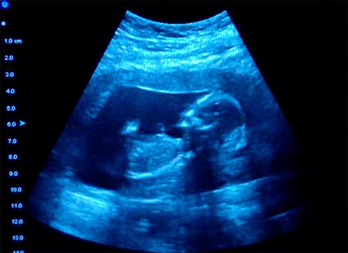 Четвертый месяц беременности развития ребенка thumbnail
