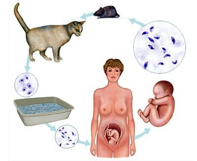 Лечение токсоплазмоза при беременности