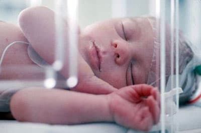 Признаки асфиксии у новорожденных