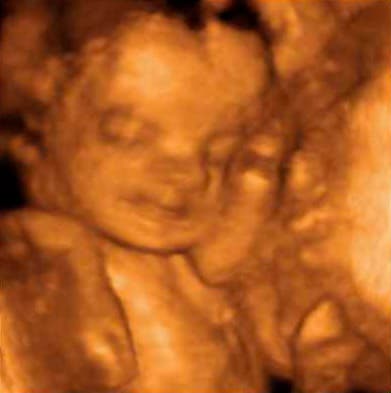 ребенок на 7 месяце беременности фото