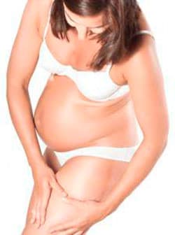 Варикоз и беременность