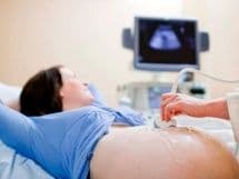 УЗИ брюшной полости при беременности