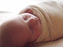 Атрезия желчных путей у новорожденных