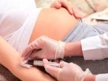 Волчаночный антикоагулянт при беременности