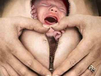 Кесарево сечение. Плюсы и минусы