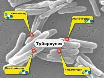 Генитальный туберкулез у женщин