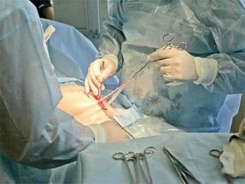 Повторное кесарево: что нужно знать каждой маме