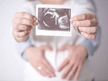 УЗИ для определения беременности
