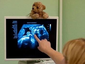 Порок сердца у плода при беременности