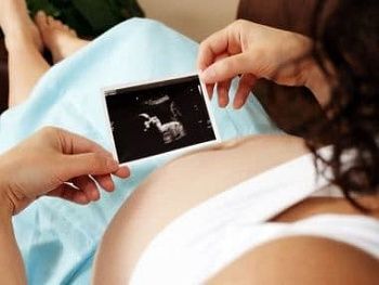 Почему происходят роды